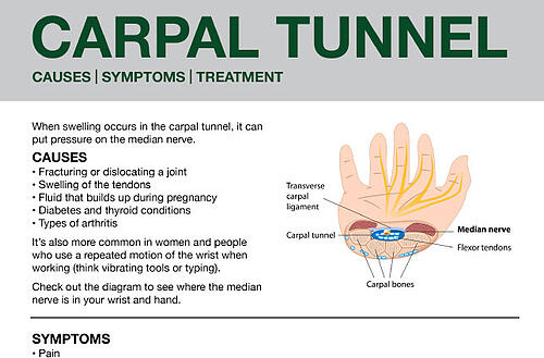 Carpal Tunnel Guide