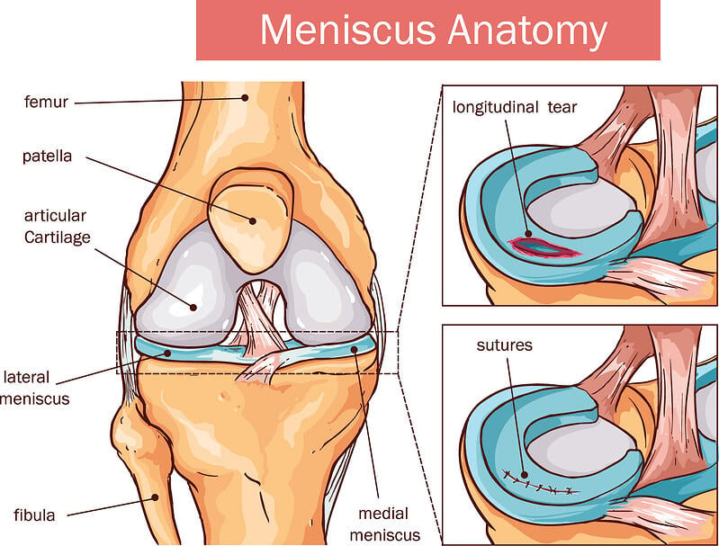 Meniscus anatomy graphic – knee replacement surgery